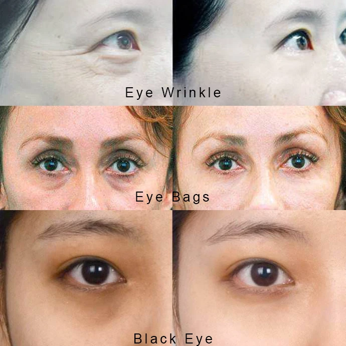 Bamboo, Charcoal, and Collagen Under-Eye Treatment (12-Pack) (4)