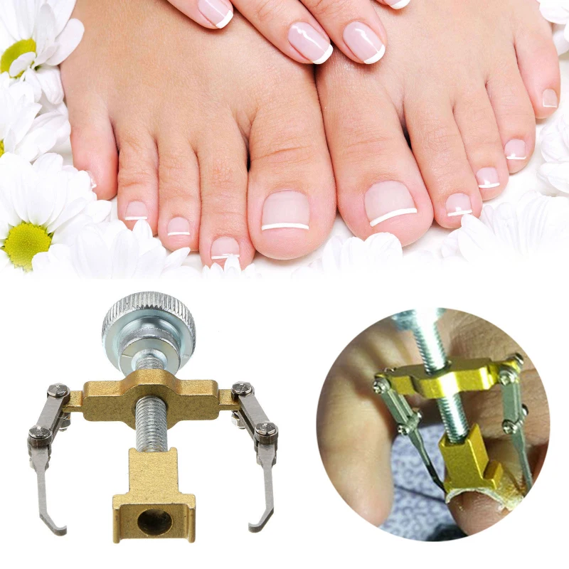 2PC Ingrown Toe Nail Recover Correction Tool Pedicure Toenail Fixer Foot Care | Красота и здоровье