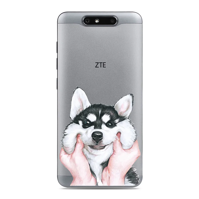 Fashion Phone Cases for ZTE Blade V8 5.2 Soft Silicone Back Cover Case For ZTE Blade V8 V 8 ZTE V8 Phone bag Cover Fundas Capa (3)