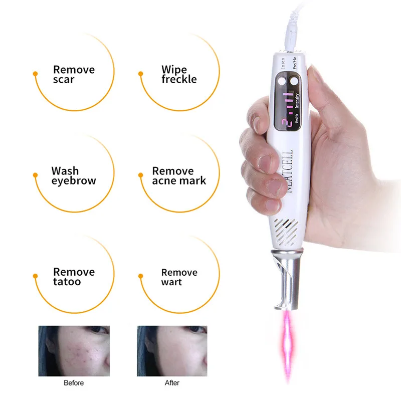Picosecond Laser Pen BlueRed Light Therapy Pigment Tattoo Scar Mole Freckle Removal Laser Acne Treatment Machine Skin Care  (2)