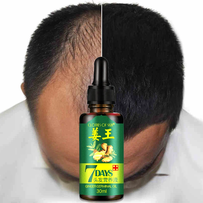 姜王4