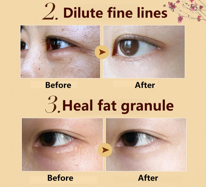 60pcs=30packs Beauty Gold Crystal Collagen Eye Skin Care Eye Patches for Dark Circles, Puffiness, Wrinkles and Bags Eye Gel