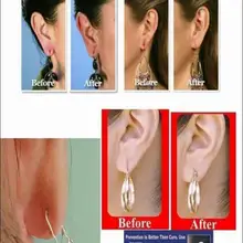 Invisible ear lift patch as Ear Lobe Support Tape for prevent stretched or torn ear lobes protect sticker AS SEEN ON TV.