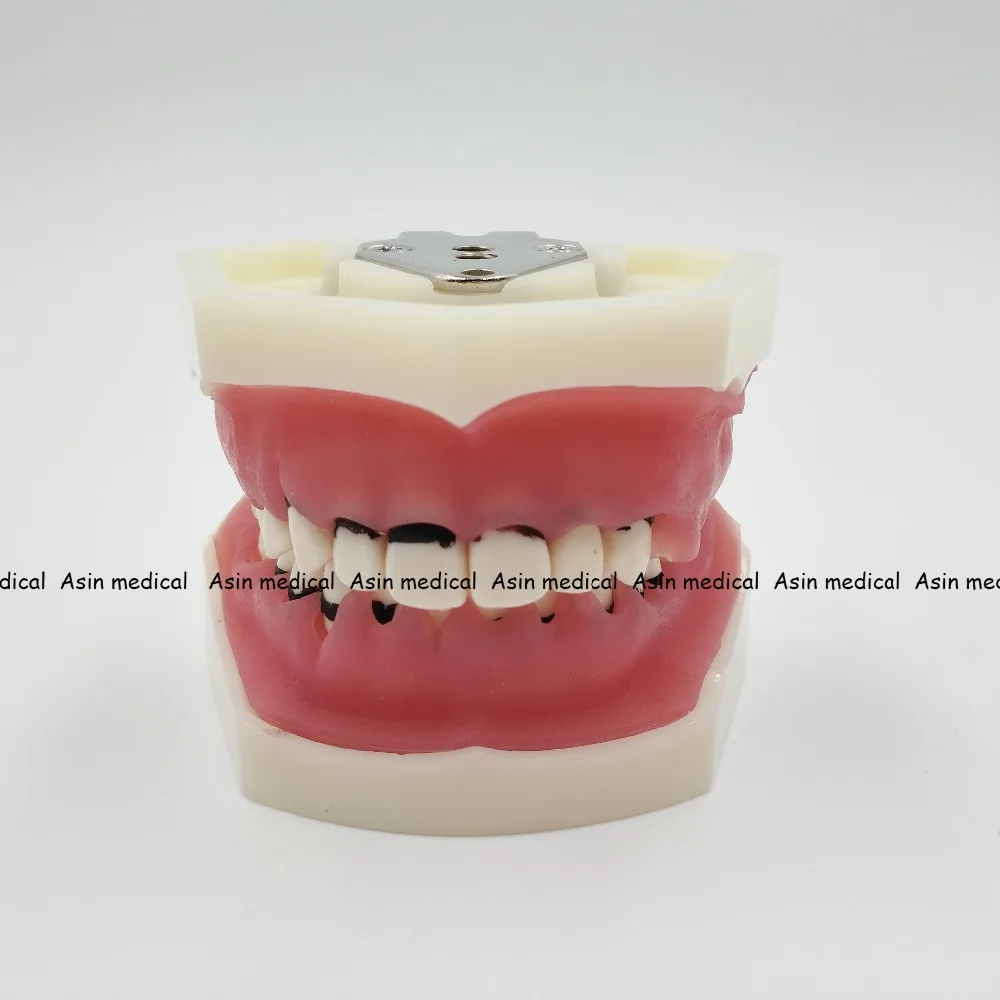 Modelo de Aprendizagem Modelo de Doença Deasin Novo Dentista Periodontal Dente - Modelo Médico 8 Cheap Clareamento dos dentes