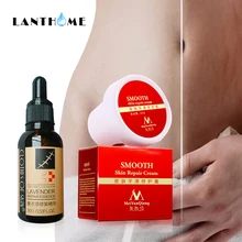 2 шт экстракт лаванды, драгоценная кожа, эссенция для тела, средство для удаления растяжек, удаление шрамов, мощный крем для беременных после родового ожирения