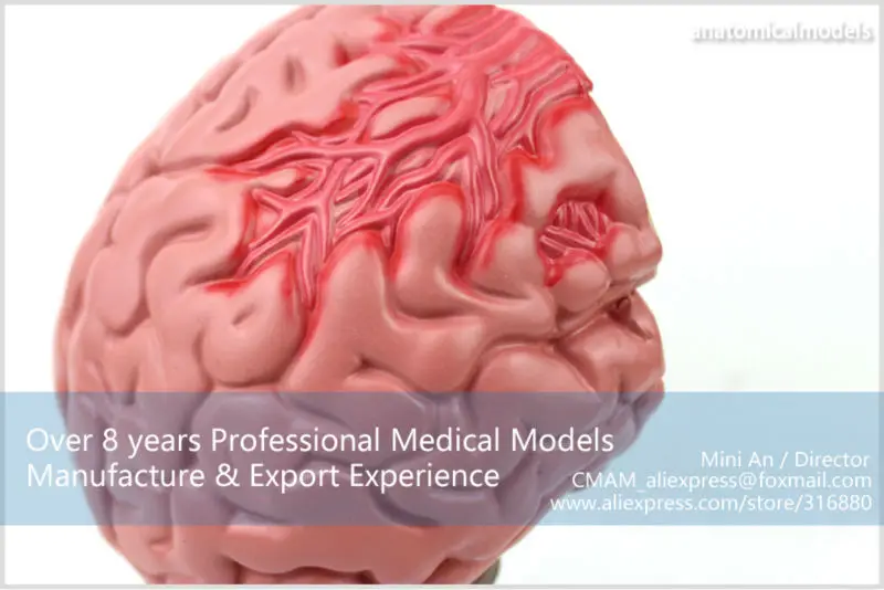 BRAIN10 CMAM model brain diseases anatomical model 6