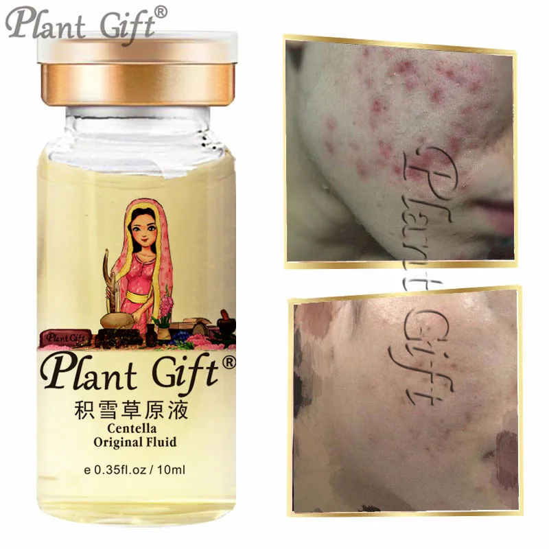 

Hot Sale Centella Original liquid Moisturizing Skin Anti Acne Whitening Moisturizing Anti Aging Serum Treatment 10ml*2pcs