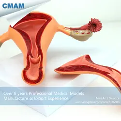 12442 cmam-anatomy04 анатомическая женских половых Системы матки яичника модели, Медицинские товары учебных анатомические модели
