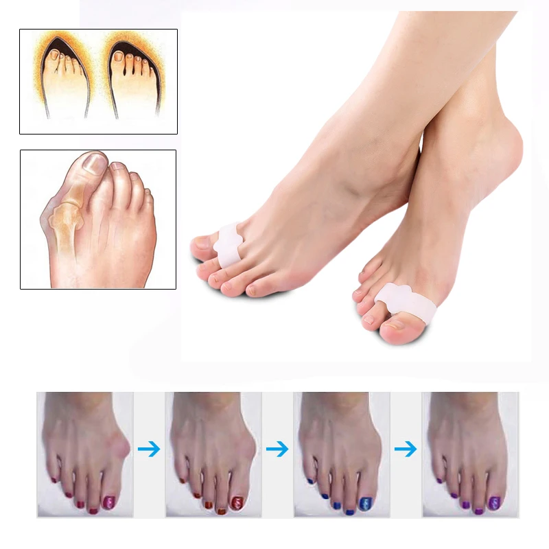2PCS=1Pair Silicone Gel Foot Care Tool Bunion Corrector Bone Big Toe Protector Hallux Valgus Corrector Toe Straightener Pedicure