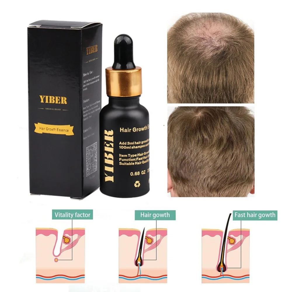 20ml Hair Growth Essential Oil Anti Hair Loss Product Natural Hair