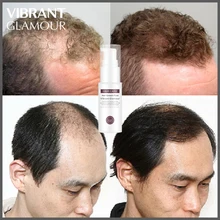 VIBRANTGLAMOUR Ginseng Hair Growth Essence Essential Oil Powerful Anti-hair Hair Loss Liquid Spray Prevention Pilatory Care Oil