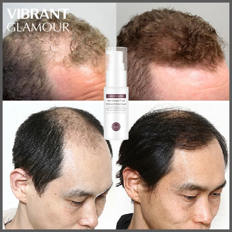 

VIBRANTGLAMOUR Powerful Hair Growth Essence Essential Oil Anti-hair Hair Loss Liquid Spray Prevention Pilatory Care Oil 30ML