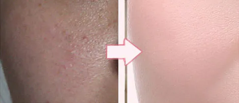 aeProduct.getSubject()