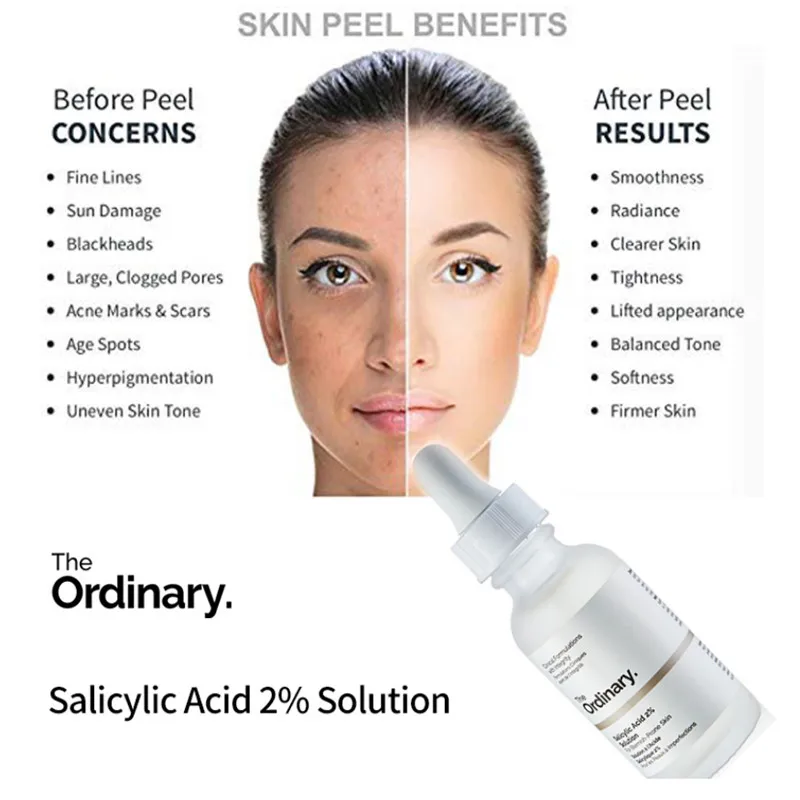 

The Ordinary 30 mL Fast Effective Works Salicylic Acid 2% Solution on Acne Blemishes Facial Acid Skin Peel Exfoliating