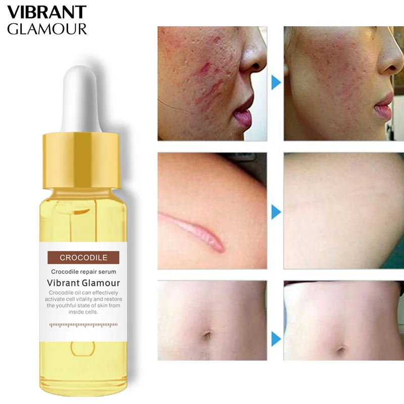 crocodile cream for stretch marks