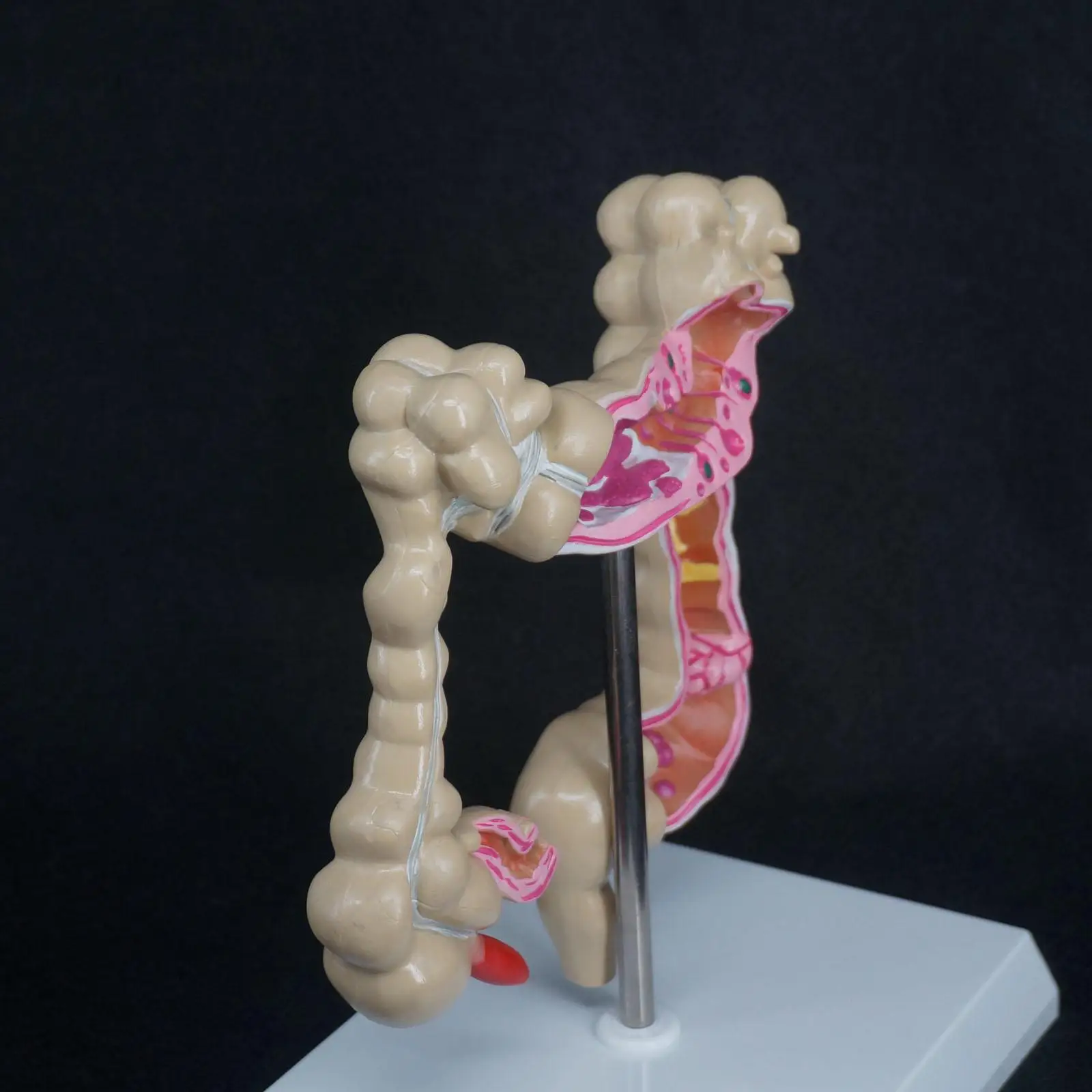 

Human colon colonic pathological disease model organ anatomy teaching resources