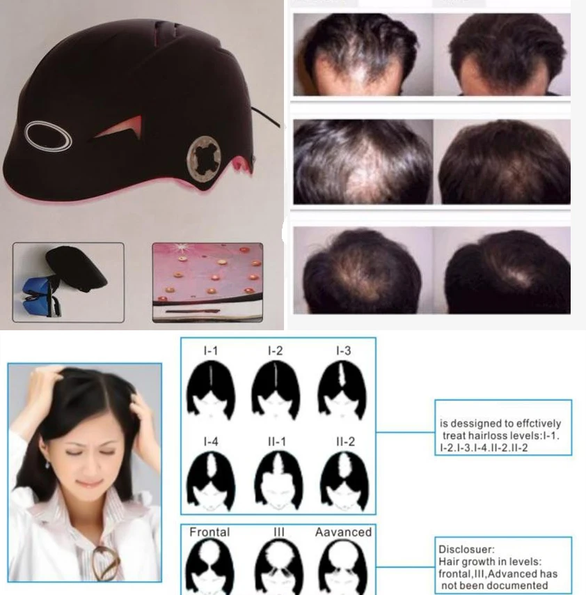 Восстановление волос лазерный шлем 64 медицинские диоды лечение облысения волос решения быстрое отрастание Лазерная Кепка+ стекло для продажи