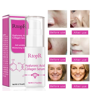 

Hyaluronic Acid Collagen Stock Solution Moisturizing Anti Wrinkles Aging Lifting Firming Whitening Skin Elasticity Serum Cream