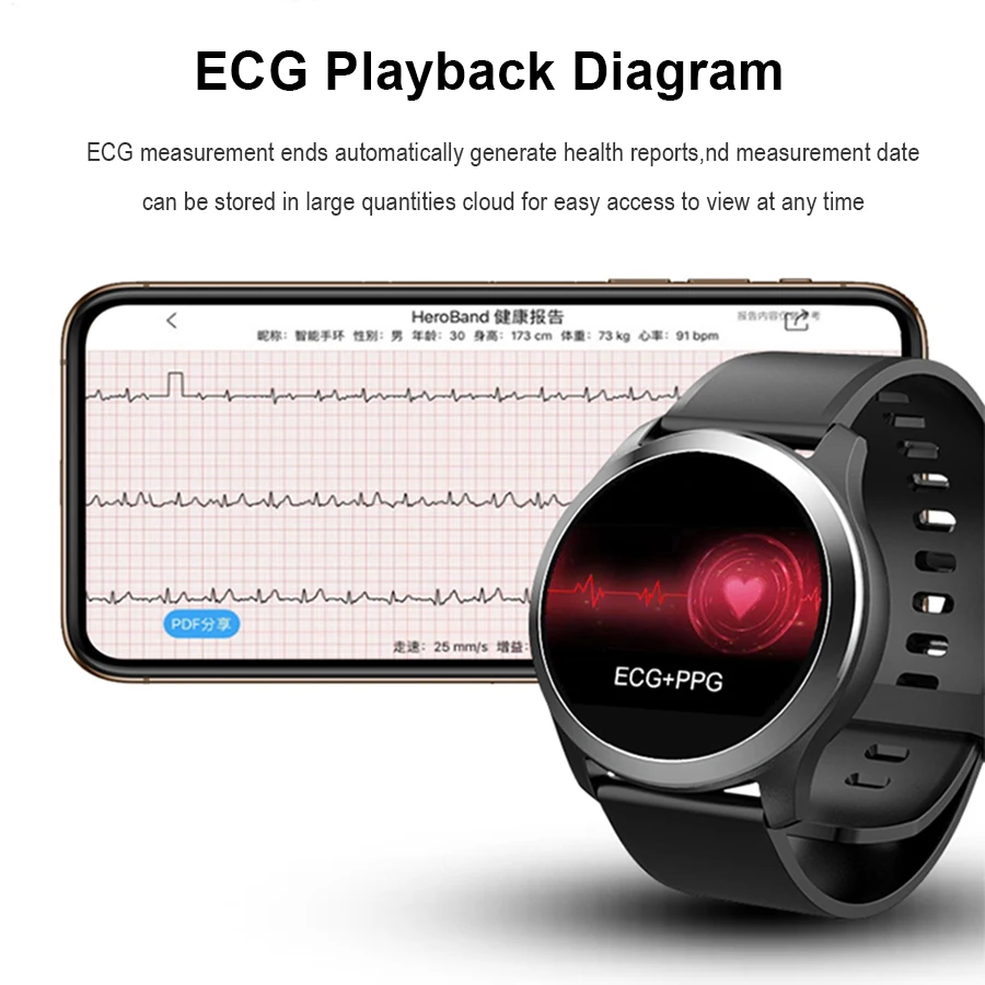 Vwar IP68 Водонепроницаемые Смарт часы ЭКГ PPG измерение кровяного давления фитнес
