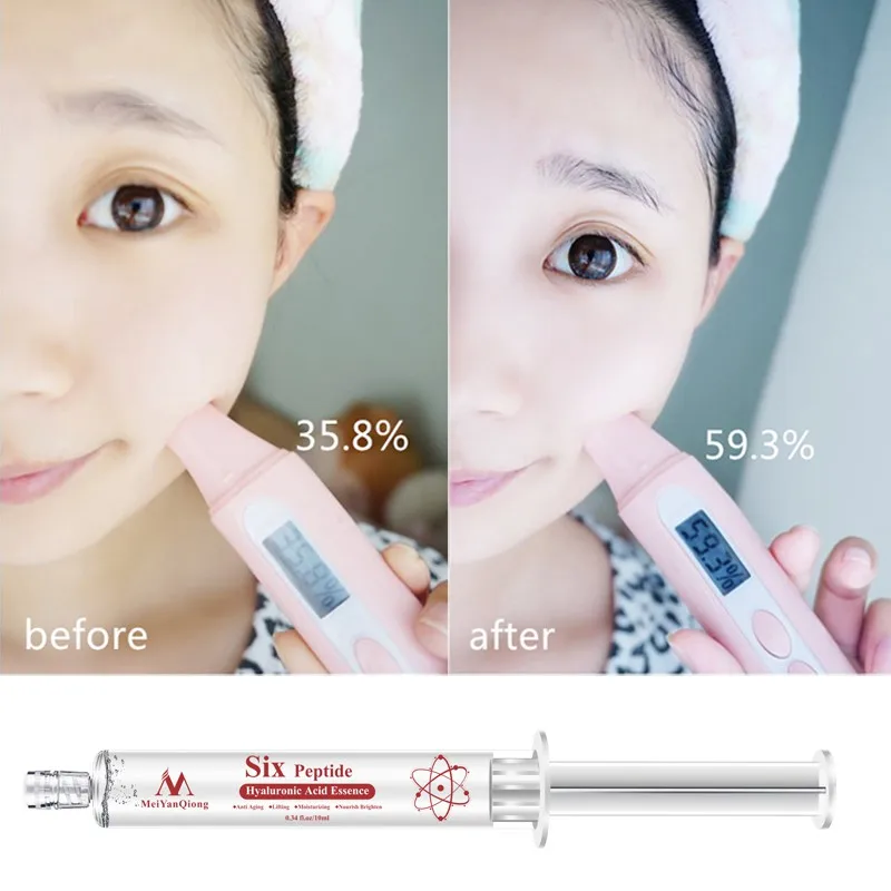 QX0339A (2)
