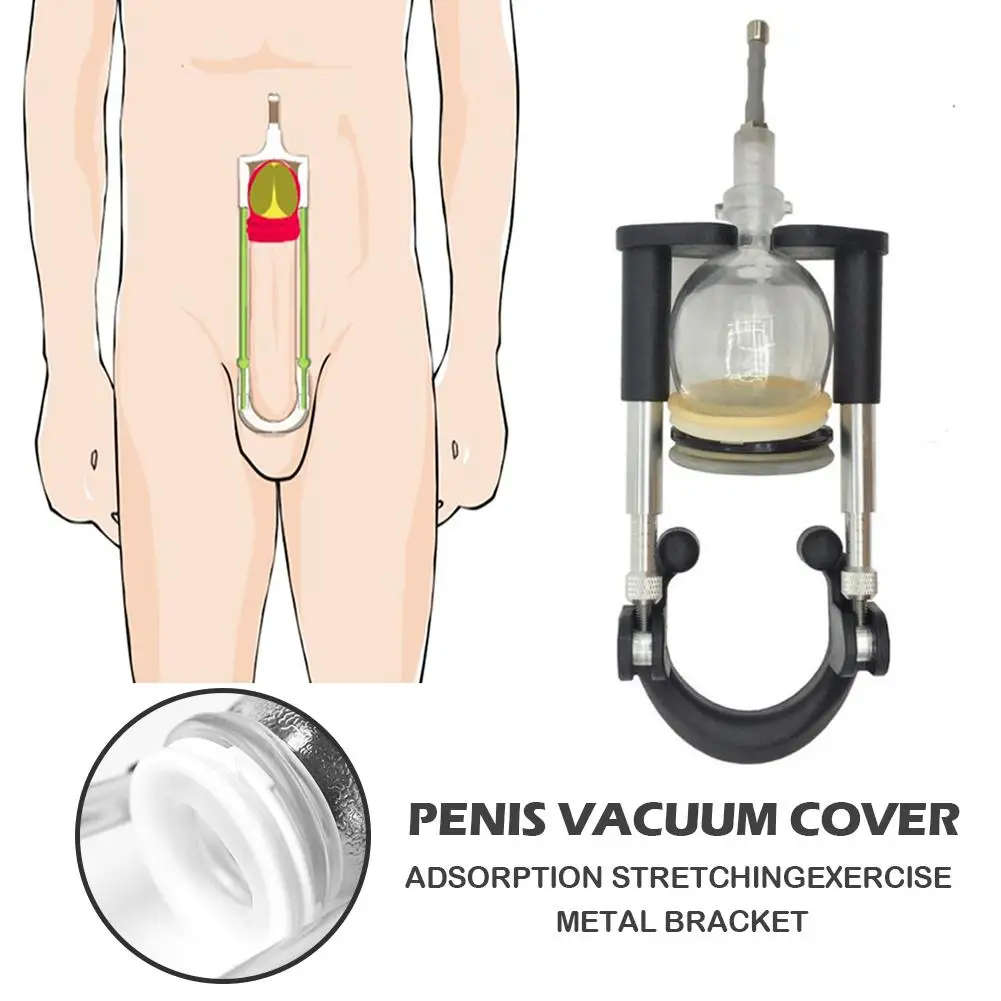 stent penis
