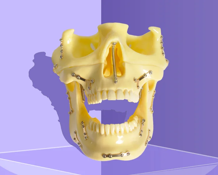 Модель зубного импланта голова бинт для фиксации при переломах модель зубы демонстрация 1 шт