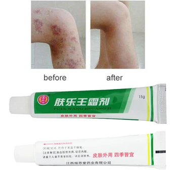 FULEWANG Skin Psoriasis Cream NO BOX Dermatitis Eczematoid Eczema Ointment Treatment Psoriasis Cream