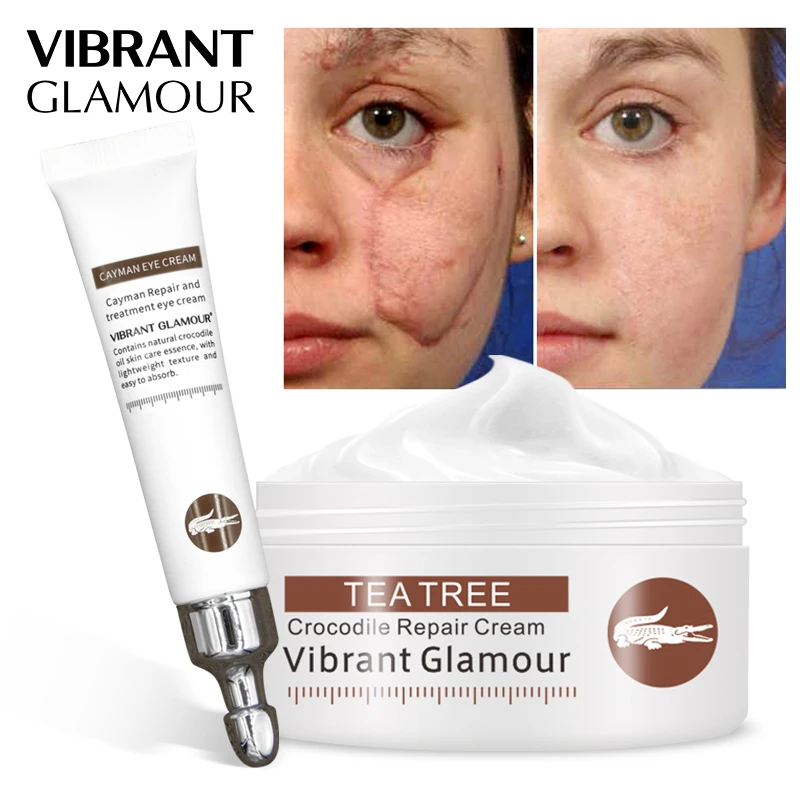 

VIBRANT GLAMOUR Crocodile Repair Cream+Anti Wrinkle Eye Cream Remove Scar Remover Dark Circles Moisturizing Against Puffiness