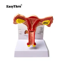 Female Internal Reproductive System Anatomical Model Uterus Ovary Reproductive Structure Model Gynecologist Recommended detailed anatomical urinary system model