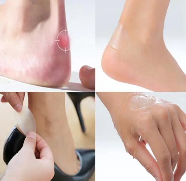 36020181120165537262