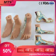 3Pcs/set Normal feet,flatfoot,Bow foot model human foot anatomical pathology model ankle joint traumatic pistol iso foot anatomy model anatomical foot model