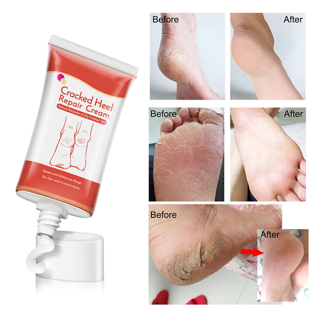 

50ml Pure Natural Winter Medical Ointment Hand Foot Repair Frostbite Anti Dry Crack Cream Treat Skin Cracks Relieves Swelling