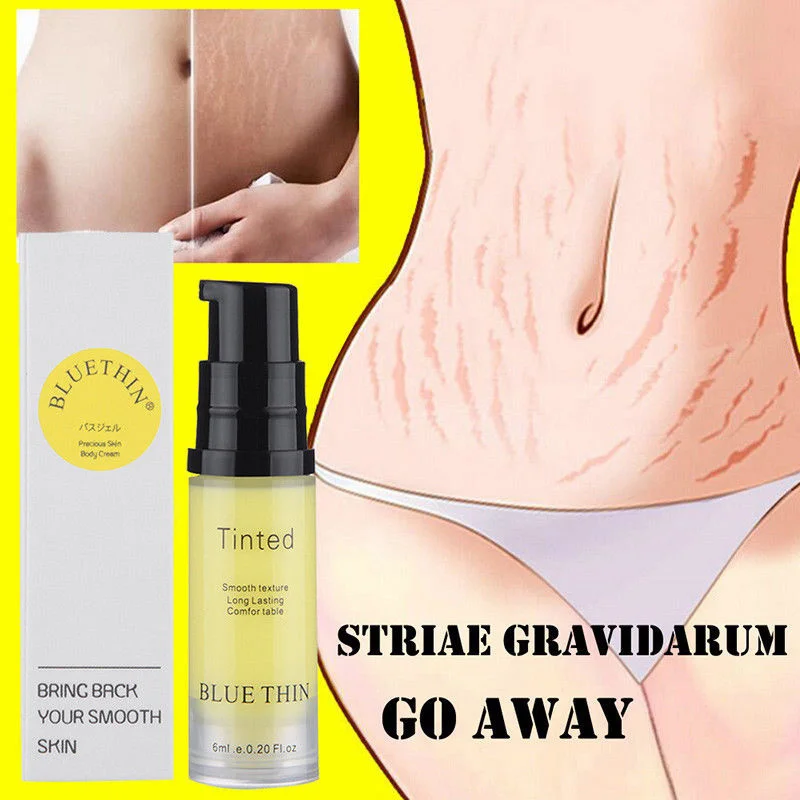 

Natural Mild Non-irritating Stretch Mark Cream Pregnancy Repair Scar Slack Line Abdomen Stretch Marks Cream Repair cream TSLM2