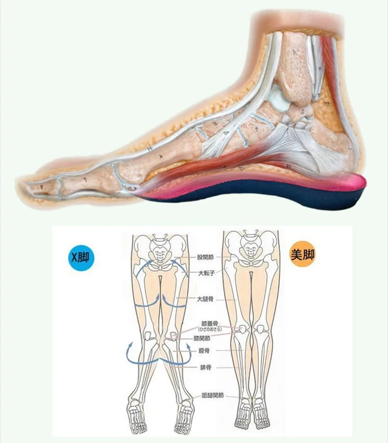 3 4 Flat Feet Orthotic Insoles Doctor Designed Foot Care Arch Heel Pain Arthritis Orthopedic Insole for Plantar Fasciitis Women X-LEG correction (7)