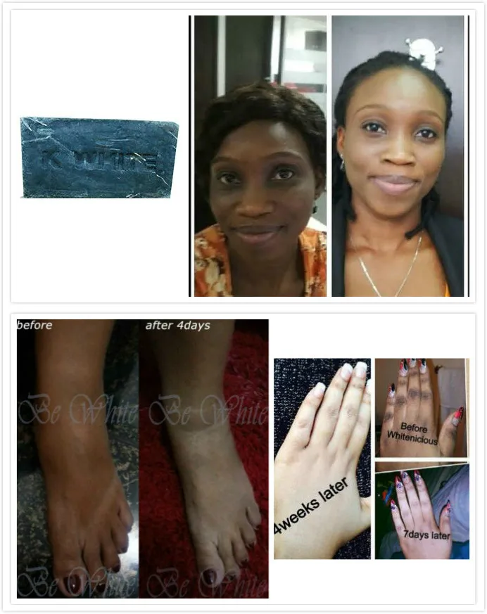 Charcoal Soap Gluta Whitening Reduce Dark Spots Soft Skin Cleaning Dark Knuckles Net 100 G Free