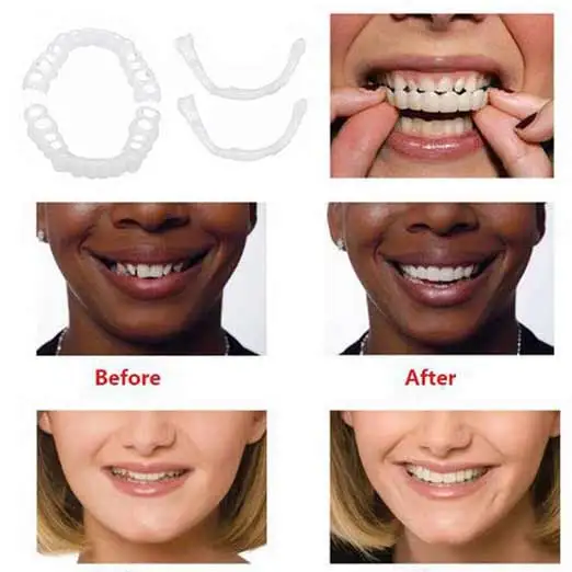 

Reusable Teeth Cover Adjustable Flex Plastic Whitening Snap Perfect Smile Denture Teeth Comfort Fit False Teeth