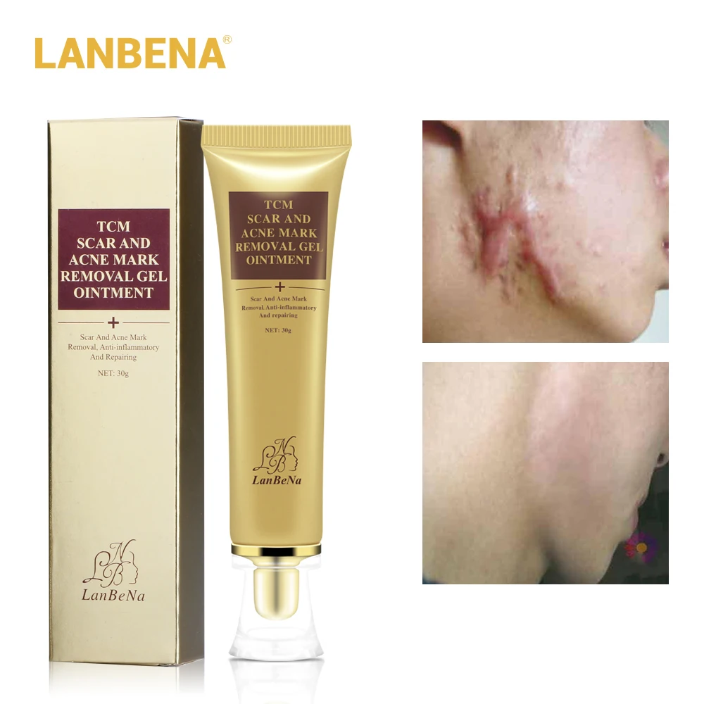 

LANBENA Remove Acne Scars Repair Gel Skin Care Red Spots Face Cream Stretch Marks Removal Skin Care