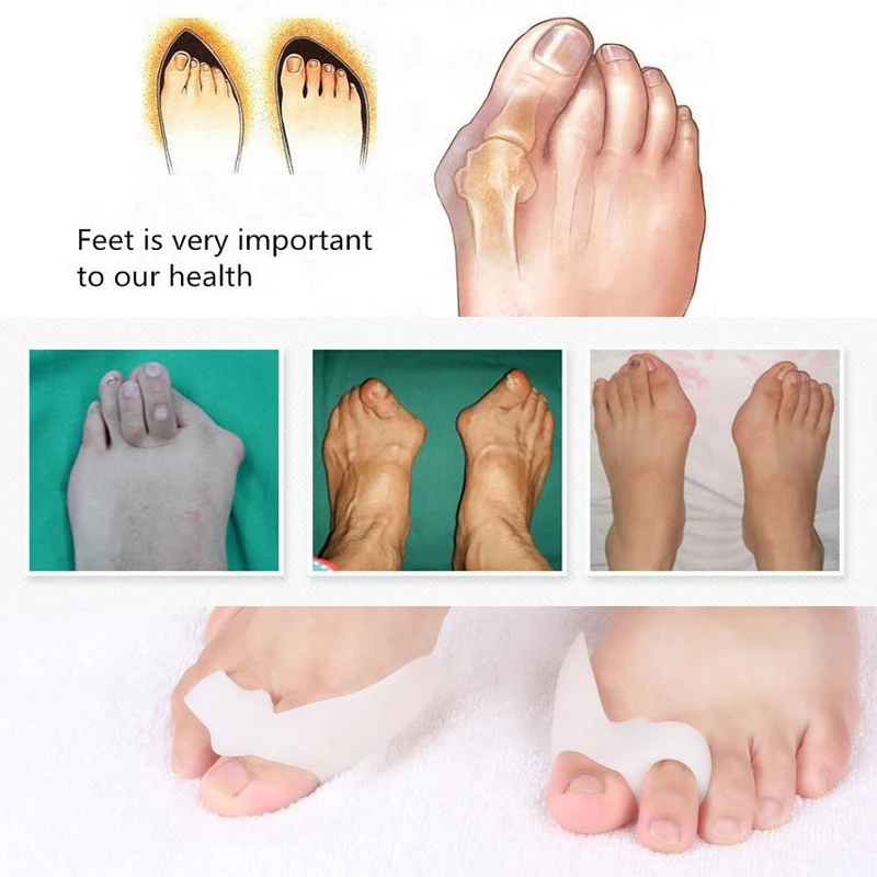 

1Pair=2pcs Feet Care Hallux Valgus Tool Bunions Care Toe Corrector Toes Thumb Braces & Supports Gel Insoles Toe Separators