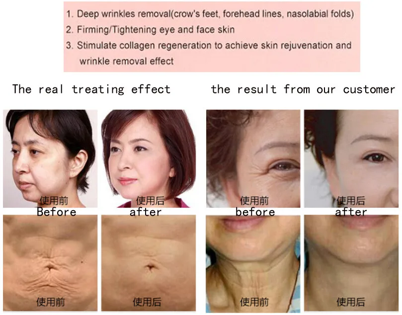 HTB1Y6q_KpXXXXbraXXXq6xXFXXXI