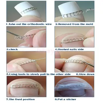 

NEW Ingrown Toenails Fixer Pedicure Recover Correction File Spring Wire Corrector Foot Nail Care Tool #5 #6 #7 #8 #10 #12