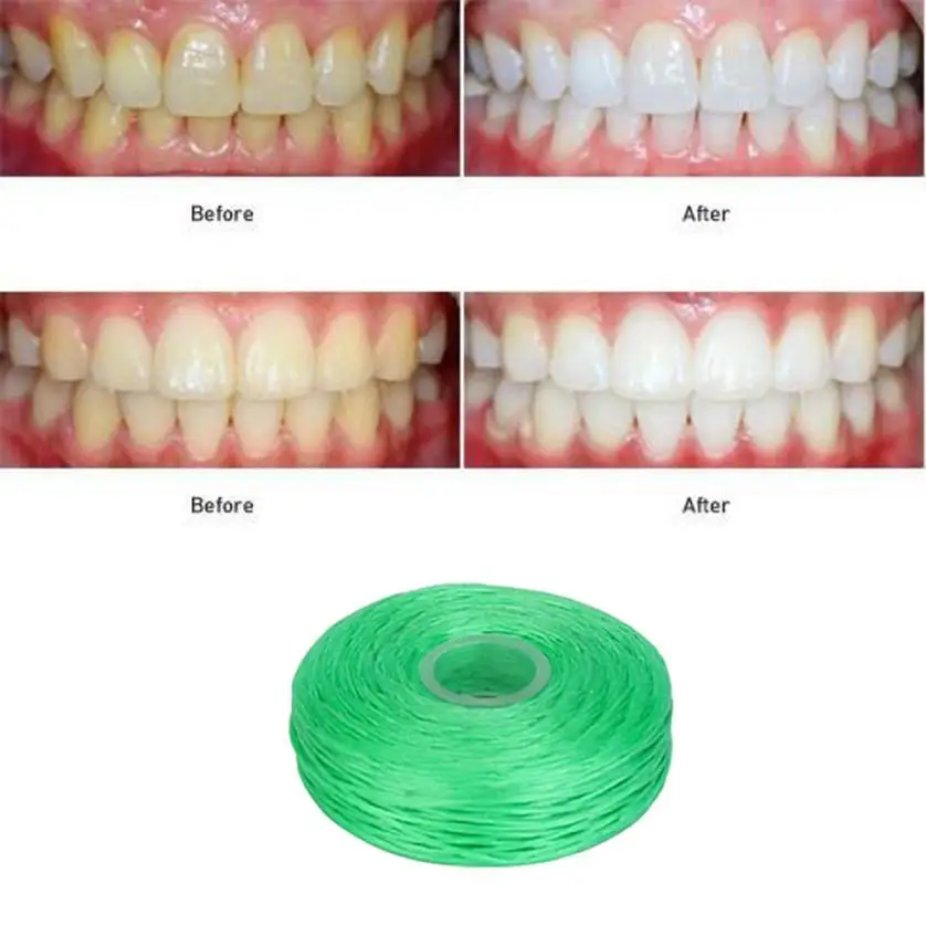 Стоматологический набор флоссов для зубов Уход за полостью грязи между зубьями удаление пятен и устранение плохого дыхания 15p1016