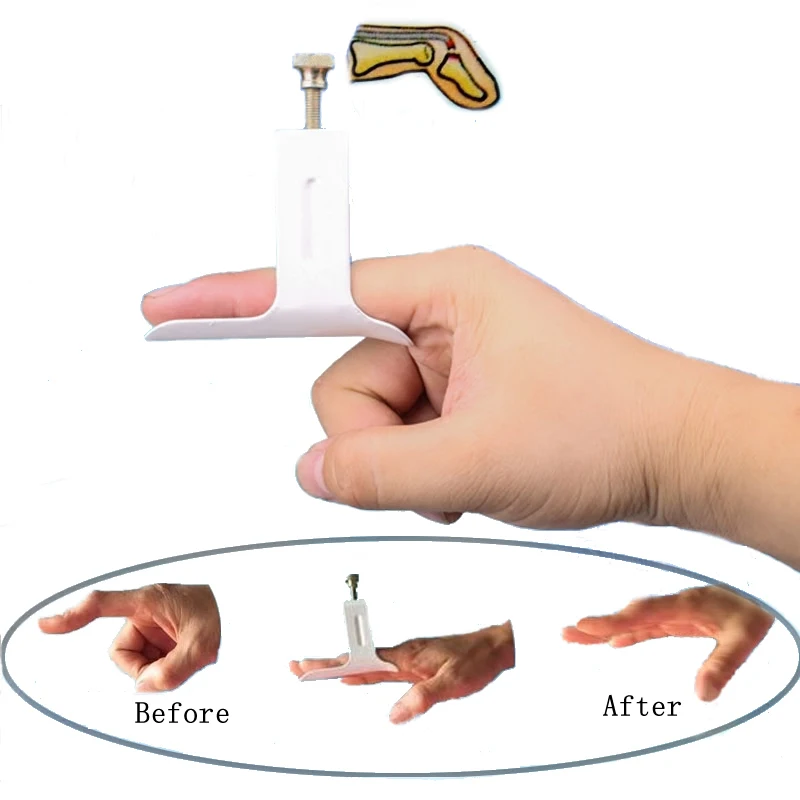 Buy Medical Finger Straightening Machine Hand Finger