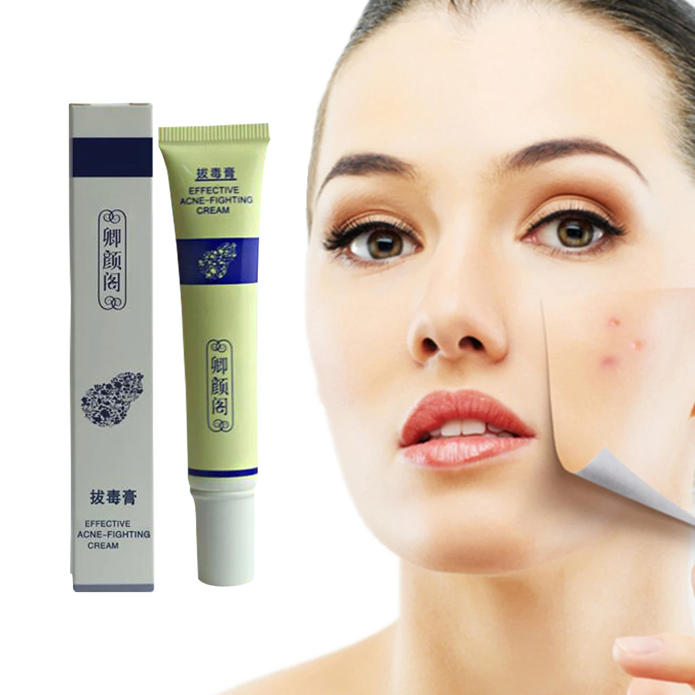QinY'G 20ML Professional Acne Scar Treatment Pock Pimple ...