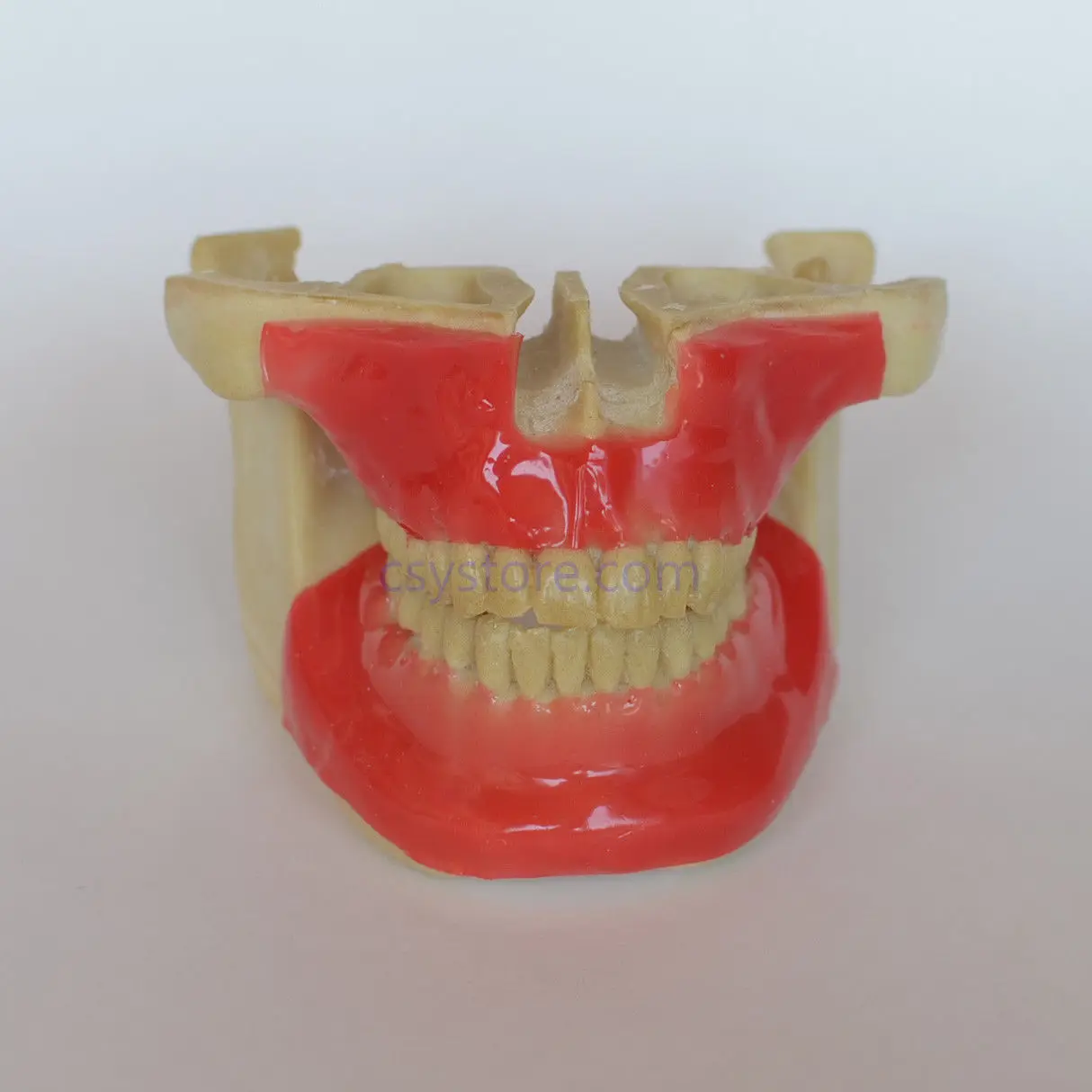 

Dental Model #203101 Orthodontic Anchor Implant Screw Practice Model with Tissue