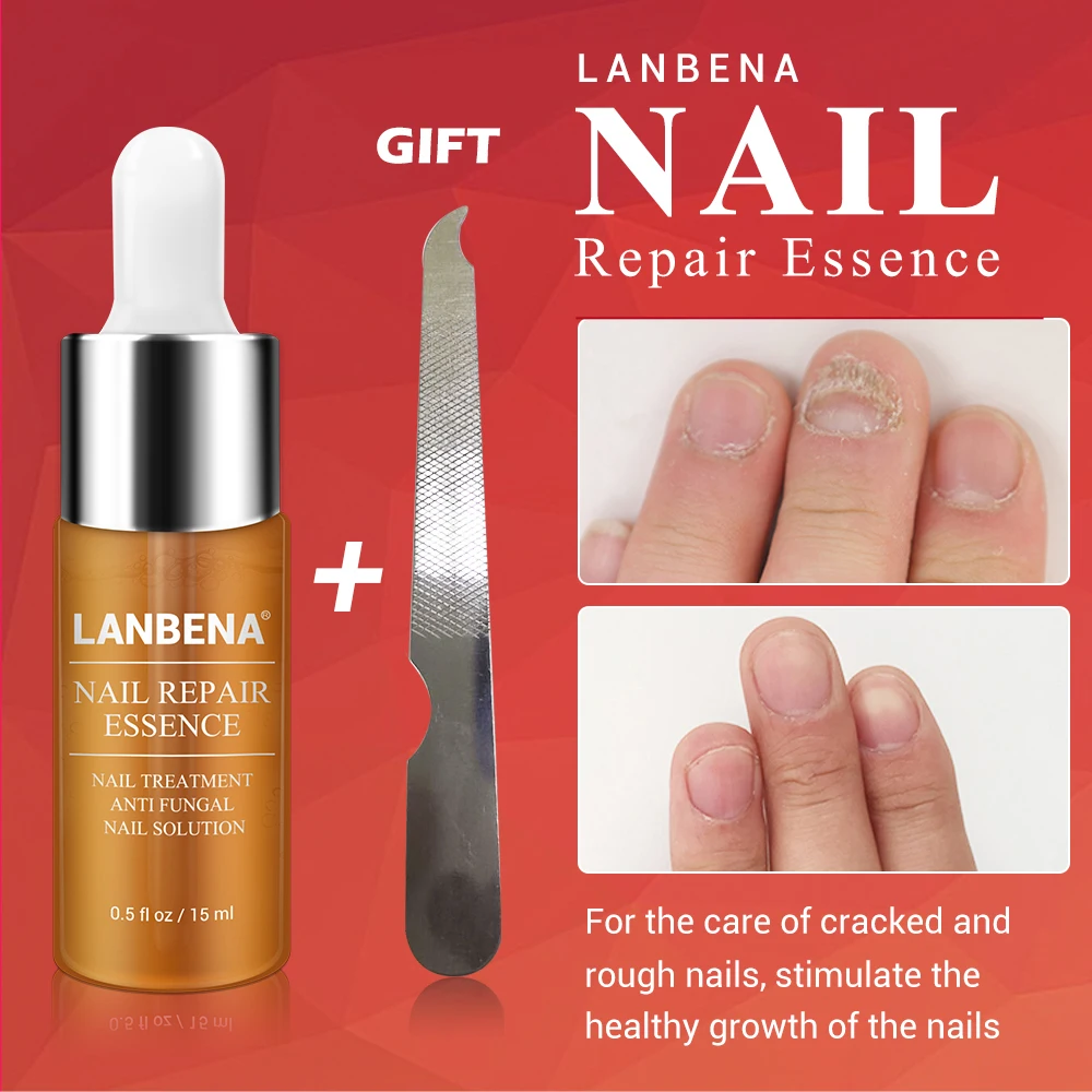 LANBENA Nail Care Gel+Nail Repair Essence Serum Nail Treatment Remove Onychomycosis Toe Nail Nourishing Hand And Foot Care 2PCS