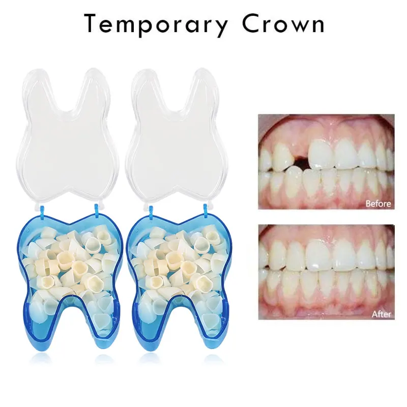 50 шт./кор. Временная зубная коронка 25 шт. для передних зубов + 25 шт. задних стоматологические материалы стоматологическая стоматологическое