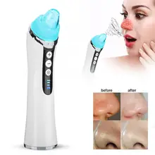 Пылесос очиститель пор электрическое удаление акне чёрных точек инструмент лицевой очистка пор инструмент Средство для устранения черных точек