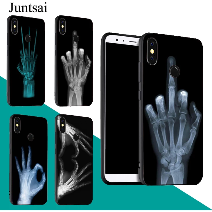 

Juntsai X-ray Hand Bones Phone Cover For Xiaomi Redmi 6 Pro 6A 5 Plus S2 Note 7 5 5A 4X Mi 8 9 6X A2 Mix 2 F1 Case