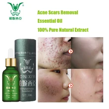 Face Care Essential Oil Acne Scar Spots Removal Skin Care Whitening Remove Scars Acne Repair Face Cream Essence Acne Treatment