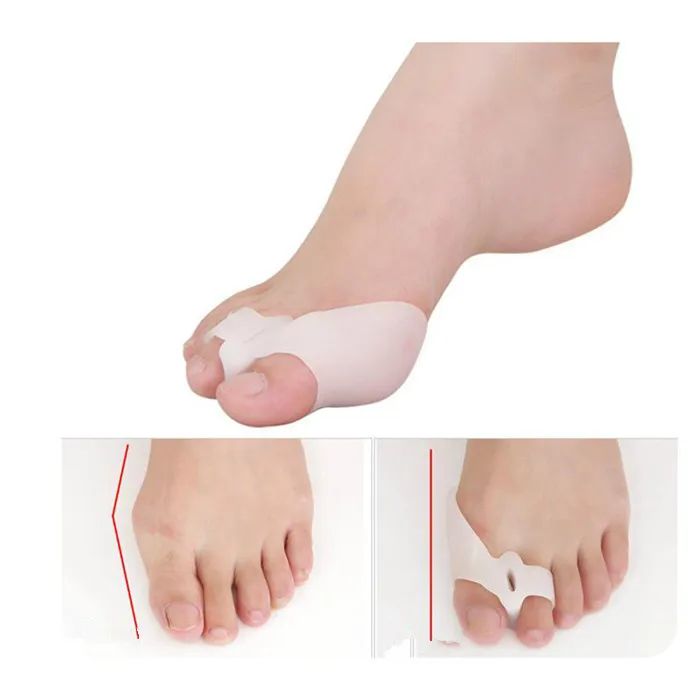 

Foot Hallux Valgus Corrector Medical Silicone Gel Big Toe Separator Bunion Protector 2PCS Pain Guard Feet Care Corrector T058OLE